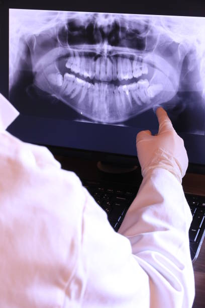 Best Knocked-Out Tooth Emergency  in Rancho Tehama Reserve, CA