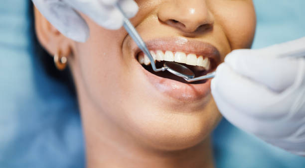 Best Urgent Tooth Repair  in Rancho Tehama Reserve, CA