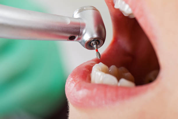 Best Tooth Infection Emergency Dentist  in Rancho Tehama Reserve, CA